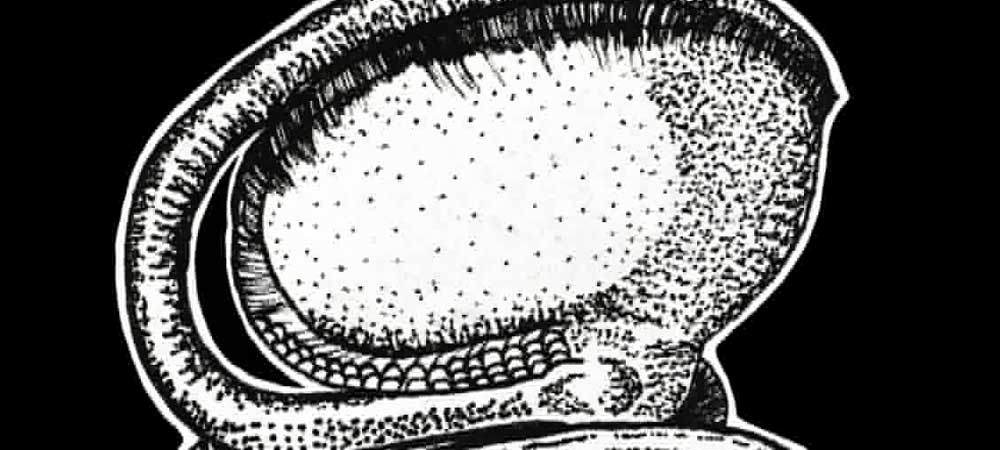 About VISUAL DISTURBANCES